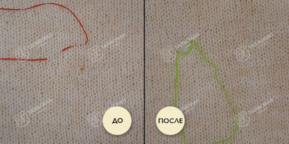 Дырки от затяжки до и после – photo2